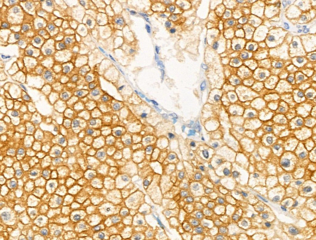 Phospho-GRB10 (Ser476) Antibody in Immunohistochemistry (Paraffin) (IHC (P))