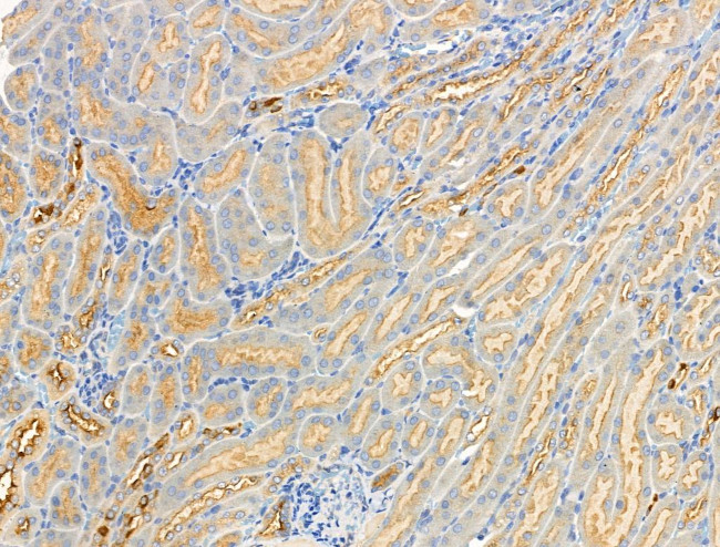 Phospho-GRB10 (Ser476) Antibody in Immunohistochemistry (Paraffin) (IHC (P))