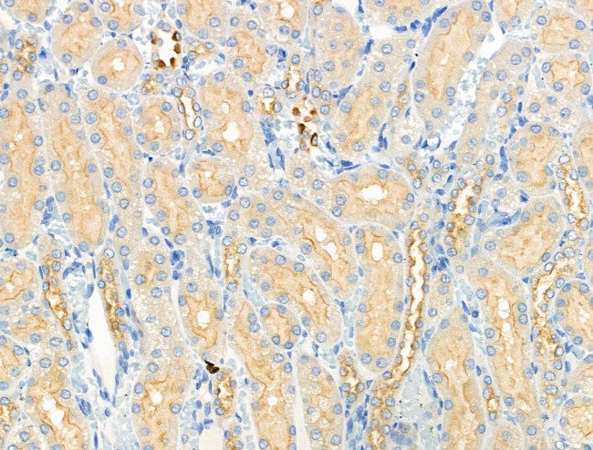 Phospho-GRB10 (Ser476) Antibody in Immunohistochemistry (Paraffin) (IHC (P))