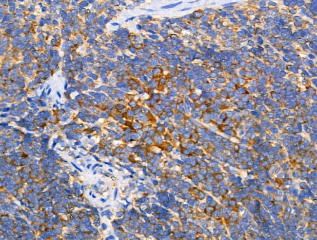 Phospho-eIF3b (Ser154) Antibody in Immunohistochemistry (Paraffin) (IHC (P))