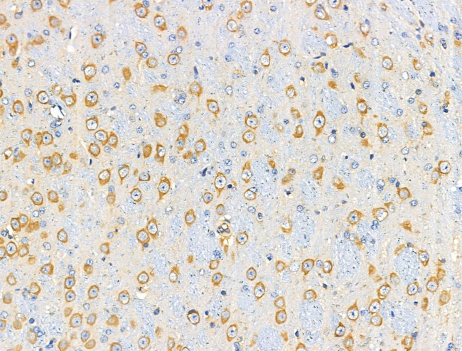 Phospho-eIF3b (Ser154) Antibody in Immunohistochemistry (Paraffin) (IHC (P))