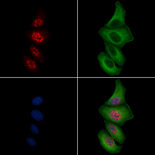 Phospho-JunB (Thr102, Thr104) Antibody in Immunocytochemistry (ICC/IF)