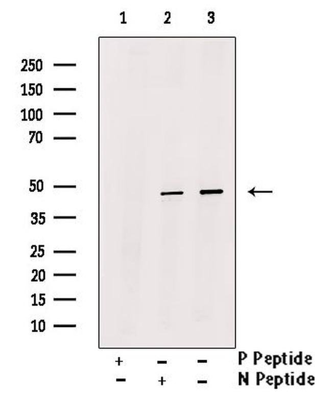 Phospho-JunB (Thr102, Thr104) Antibody in Western Blot (WB)