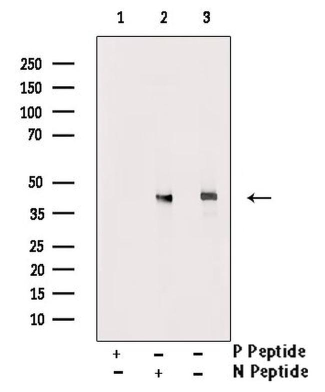 Phospho-LAT (Tyr200) Antibody in Western Blot (WB)