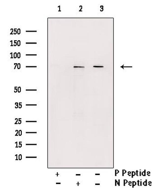 Phospho-L-Plastin (Tyr28) Antibody in Western Blot (WB)