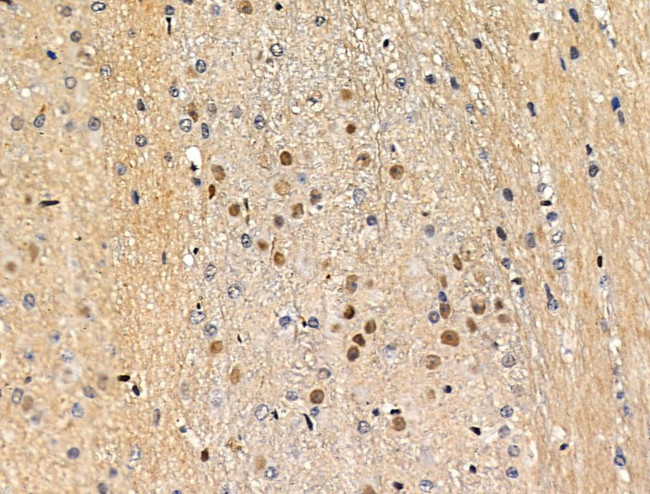 Phospho-MEF2A (Ser408) Antibody in Immunohistochemistry (Paraffin) (IHC (P))