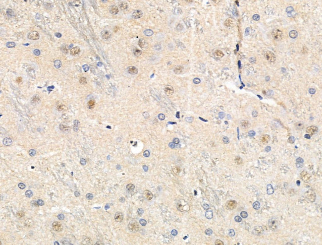 Phospho-MEF2A (Ser408) Antibody in Immunohistochemistry (Paraffin) (IHC (P))