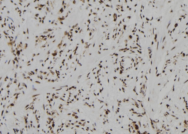 Phospho-MEF2A (Ser408) Antibody in Immunohistochemistry (Paraffin) (IHC (P))