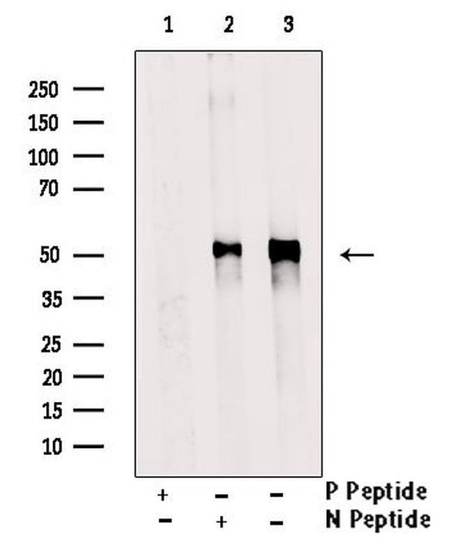 Phospho-MEF2A (Ser408) Antibody in Western Blot (WB)