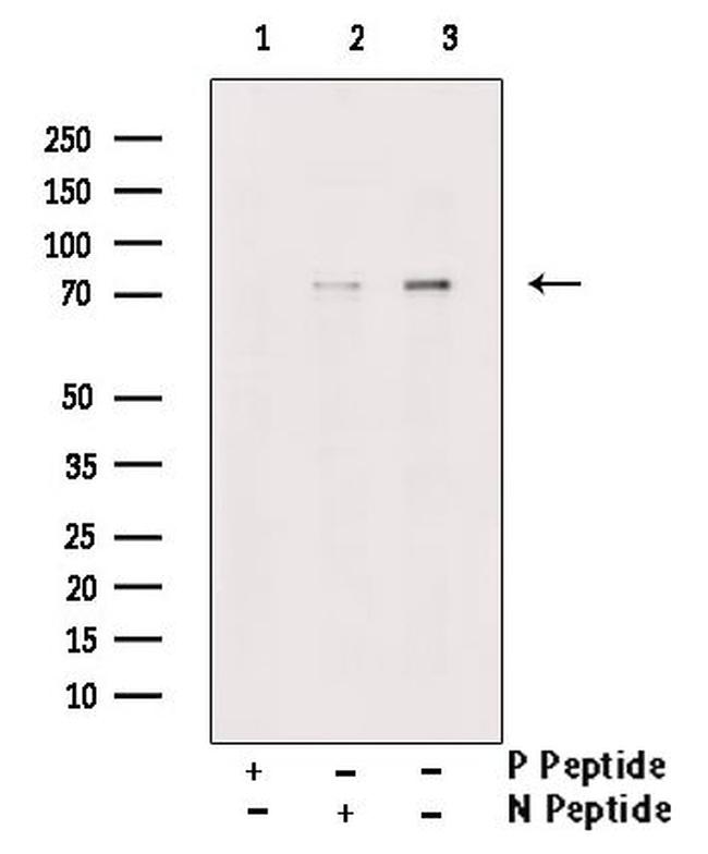 Phospho-PKMYT1 (Ser83) Antibody in Western Blot (WB)