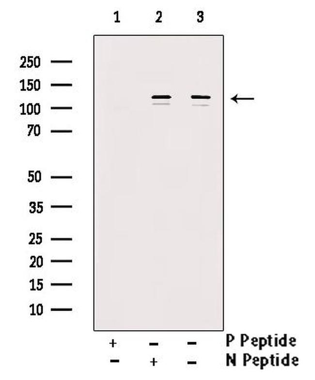 Phospho-NEDD4L (Ser448) Antibody in Western Blot (WB)