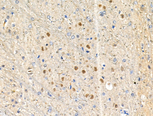 Phospho-NPM1 (Thr95) Antibody in Immunohistochemistry (Paraffin) (IHC (P))