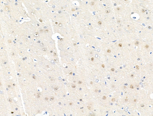 Phospho-NPM1 (Thr95) Antibody in Immunohistochemistry (Paraffin) (IHC (P))