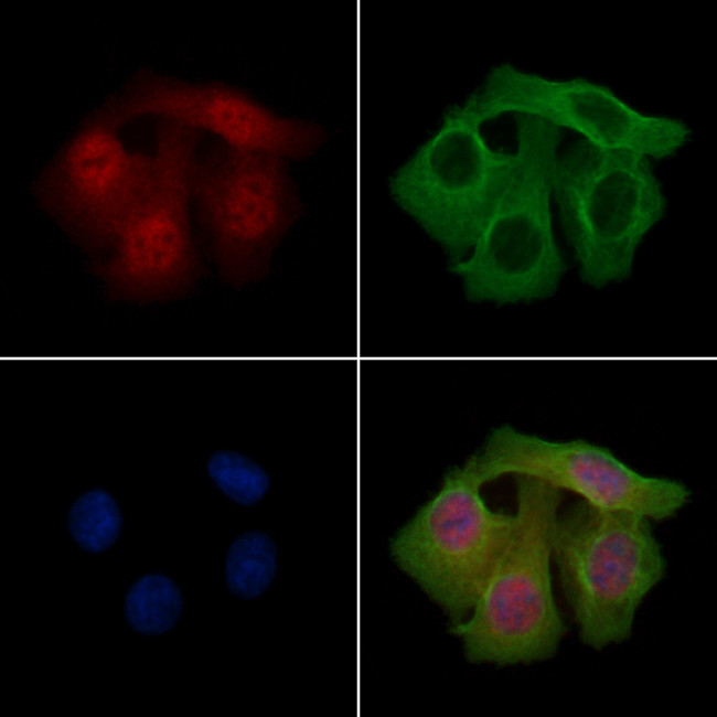 Phospho-PAK2 (Ser20) Antibody in Immunocytochemistry (ICC/IF)