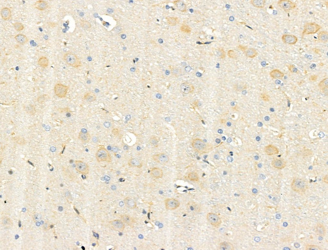 Phospho-PAK2 (Ser20) Antibody in Immunohistochemistry (Paraffin) (IHC (P))