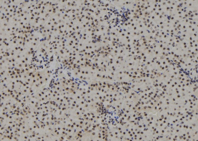 Phospho-Progesterone Receptor (Ser190) Antibody in Immunohistochemistry (Paraffin) (IHC (P))