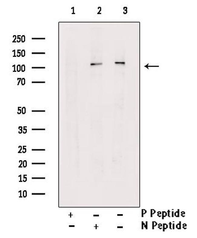 Phospho-Progesterone Receptor (Ser190) Antibody in Western Blot (WB)