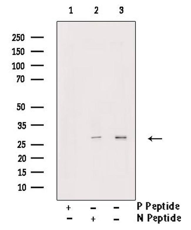 Phospho-RAC1 (Ser71) Antibody in Western Blot (WB)