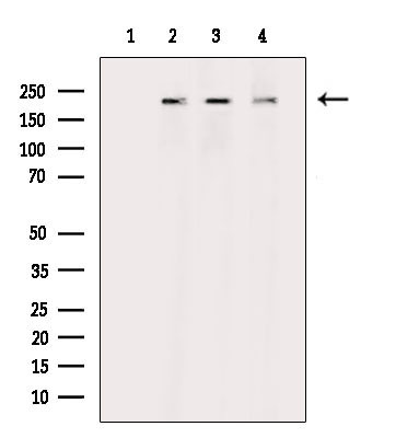 Phospho-RICTOR (Thr1135) Antibody in Western Blot (WB)