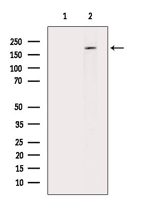 Phospho-RICTOR (Thr1135) Antibody in Western Blot (WB)