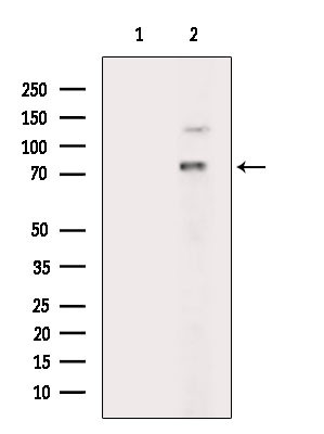 Phospho-RIP1 (Ser166) Antibody in Western Blot (WB)