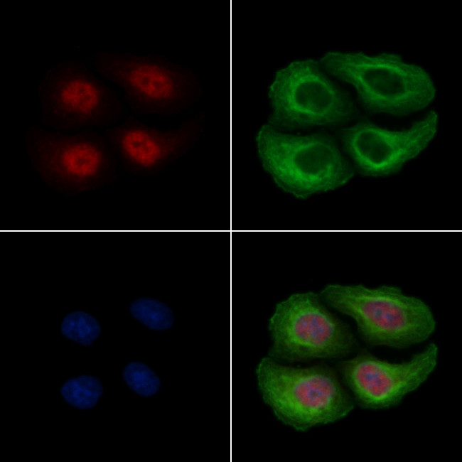 Phospho-RSK2 (Ser227) Antibody in Immunocytochemistry (ICC/IF)