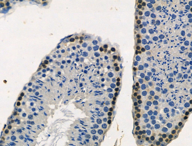 Phospho-RSK2 (Ser227) Antibody in Immunohistochemistry (Paraffin) (IHC (P))