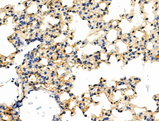 Phospho-SHIP2 (Tyr1135) Antibody in Immunohistochemistry (Paraffin) (IHC (P))