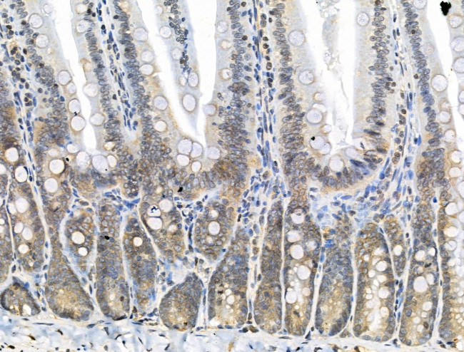 Phospho-SHIP2 (Tyr1135) Antibody in Immunohistochemistry (Paraffin) (IHC (P))