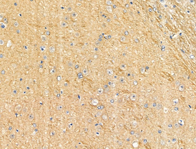 Phospho-SHIP2 (Tyr1135) Antibody in Immunohistochemistry (Paraffin) (IHC (P))