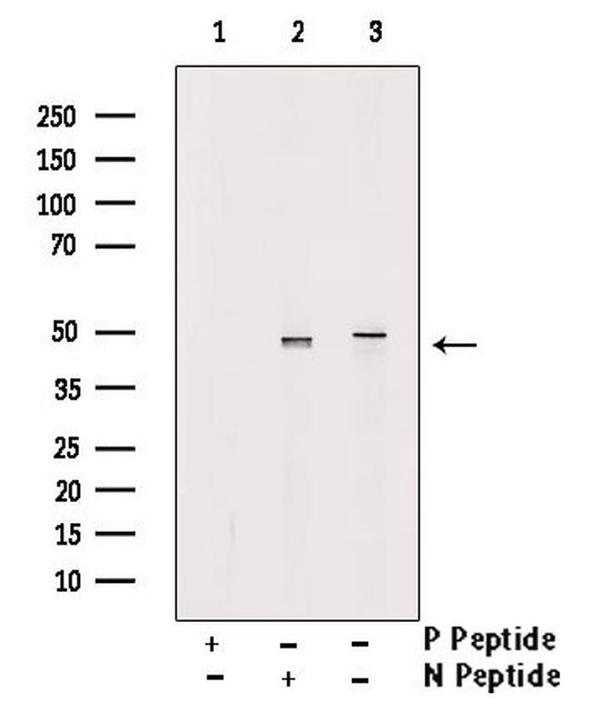 Phospho-SKP2 (Ser64) Antibody in Western Blot (WB)