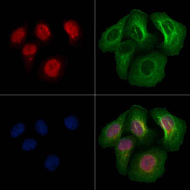 Phospho-SKP2 (Ser64) Antibody in Immunocytochemistry (ICC/IF)