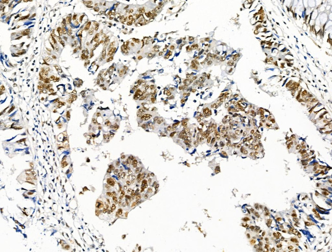 Phospho-SKP2 (Ser64) Antibody in Immunohistochemistry (Paraffin) (IHC (P))