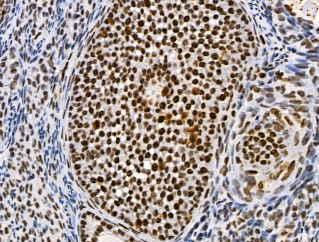 Phospho-SKP2 (Ser64) Antibody in Immunohistochemistry (Paraffin) (IHC (P))