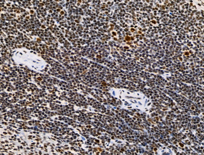 Phospho-SKP2 (Ser64) Antibody in Immunohistochemistry (Paraffin) (IHC (P))