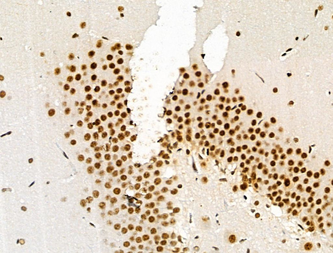 Phospho-SKP2 (Ser64) Antibody in Immunohistochemistry (Paraffin) (IHC (P))