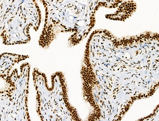 Phospho-SKP2 (Ser64) Antibody in Immunohistochemistry (Paraffin) (IHC (P))