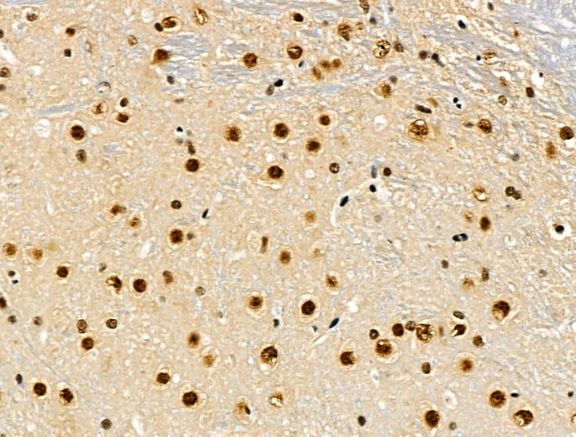 Phospho-SKP2 (Ser64) Antibody in Immunohistochemistry (Paraffin) (IHC (P))