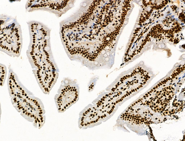 Phospho-SKP2 (Ser64) Antibody in Immunohistochemistry (Paraffin) (IHC (P))