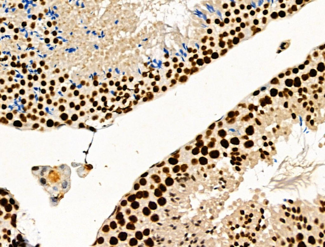 Phospho-SKP2 (Ser64) Antibody in Immunohistochemistry (Paraffin) (IHC (P))