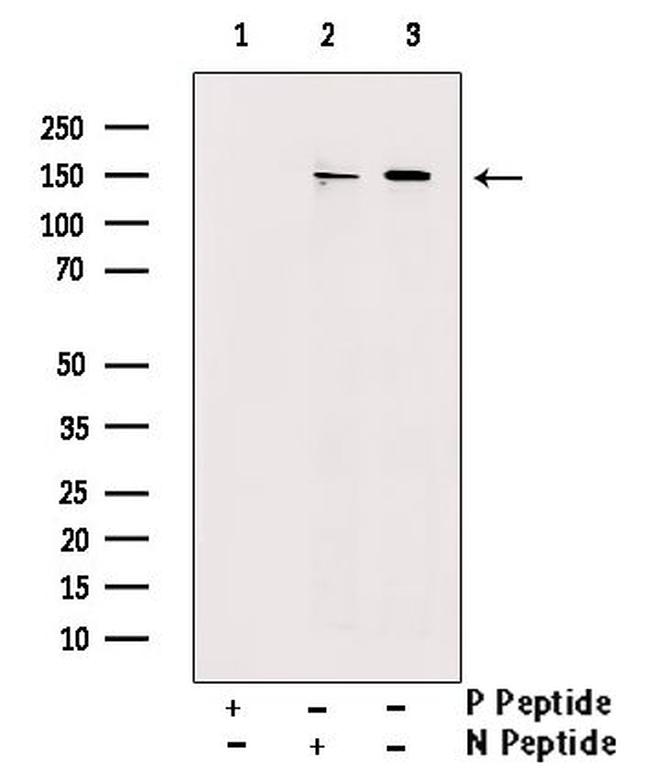 Phospho-SRC3 (Thr24) Antibody in Western Blot (WB)