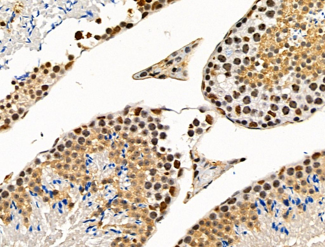 Phospho-SRC3 (Thr24) Antibody in Immunohistochemistry (Paraffin) (IHC (P))