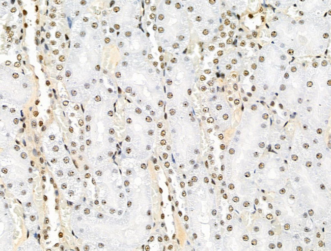 Phospho-SRC3 (Thr24) Antibody in Immunohistochemistry (Paraffin) (IHC (P))