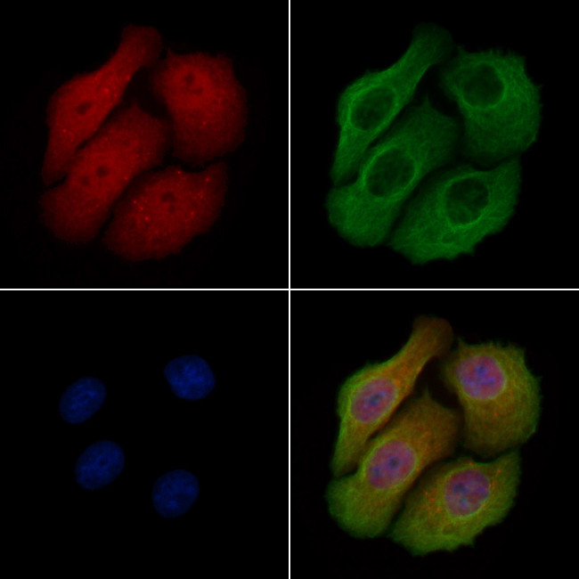 Phospho-SSH3 (Ser37) Antibody in Immunocytochemistry (ICC/IF)