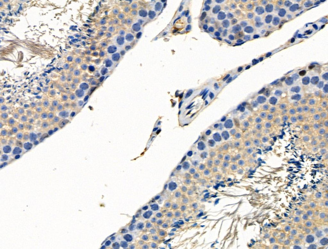 Phospho-SSH3 (Ser37) Antibody in Immunohistochemistry (Paraffin) (IHC (P))