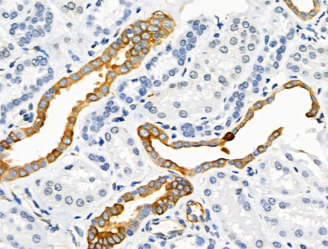 Phospho-Synapsin 1 (Ser605) Antibody in Immunohistochemistry (Paraffin) (IHC (P))