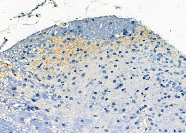 Phospho-Synapsin 1 (Ser605) Antibody in Immunohistochemistry (Paraffin) (IHC (P))