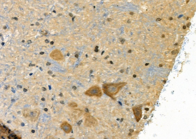 Phospho-Synapsin 1 (Ser605) Antibody in Immunohistochemistry (Paraffin) (IHC (P))