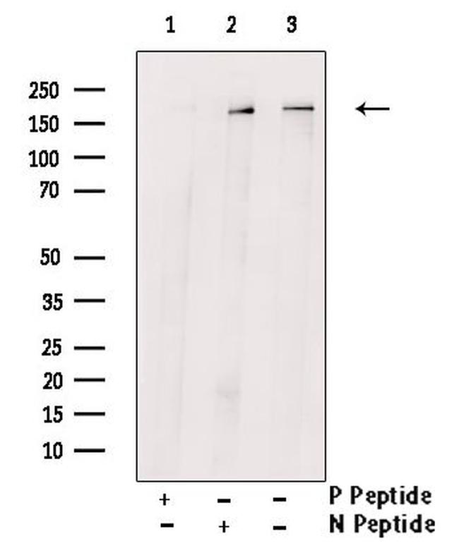 Phospho-TBC1D1 (Ser237) Antibody in Western Blot (WB)