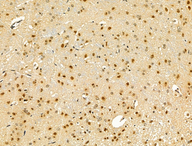 Phospho-TBC1D1 (Ser237) Antibody in Immunohistochemistry (Paraffin) (IHC (P))